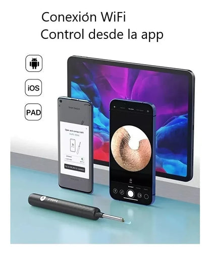 Limpiador de Oídos con Cámara HD